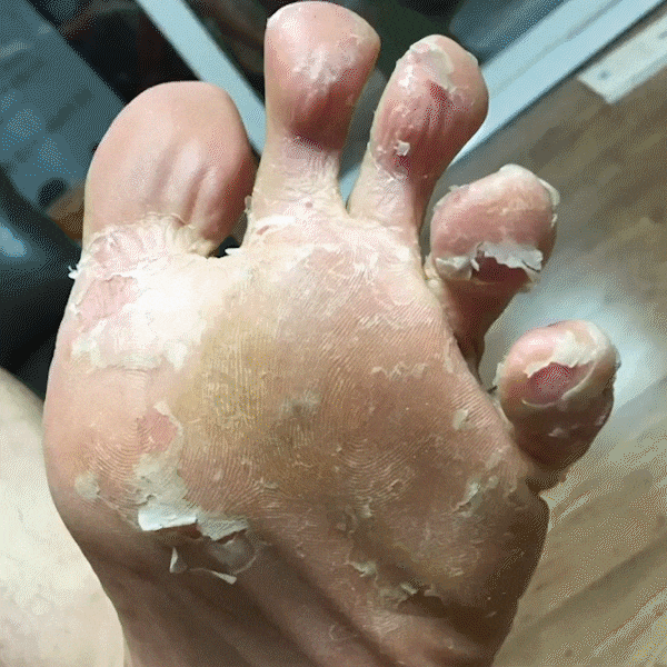 Good-bye Dirty Foot Solution | 去角質滋潤足膜