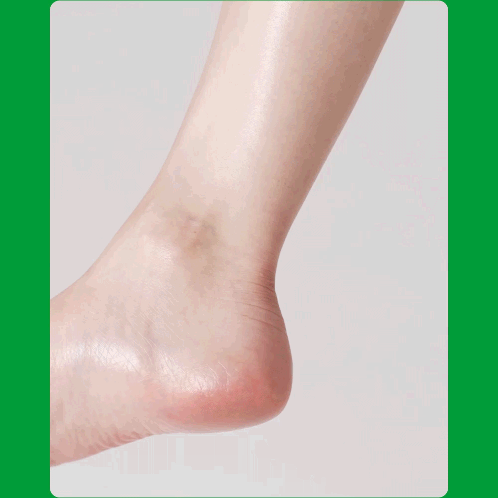 Heel Peeling Mask | 後腳跟去角質足膜 (5片組)